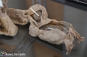 VBS_2790  - Aneurisma dell'aorta - Mostra Body Worlds